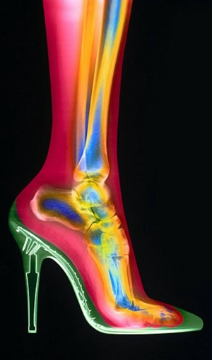 high heel xray