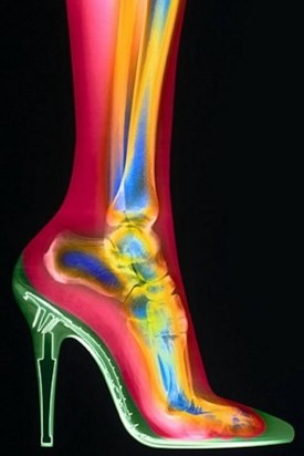 high heel x ray